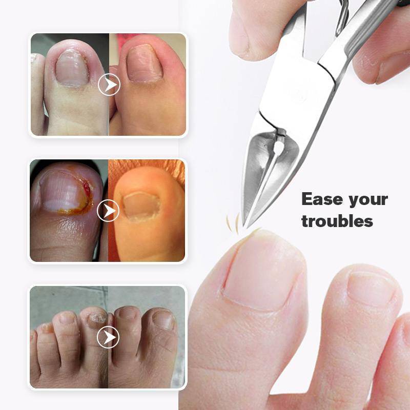Last Day Promotion（50% OFF ）Medical-grade Nail Clippers - Libiyi